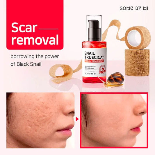 Post-Acne Scar Treatment: A Comprehensive Guide with Some By Mi Snail Truecica - Lakinza