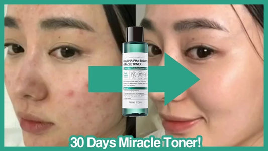 Where to buy SOME BY MI AHA BHA PHA 30 Days Miracle Toner? No.1 Acne Care Toner. - Lakinza