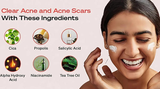 Top Korean Skincare Ingredients for Targeting Acne - Lakinza