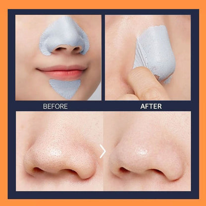 APIEU Goblin Peel Off Nose Pack 50ml Korean Skincare