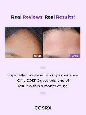 COSRX AHA/BHA Clarifying Treatment Toner 150ml Korean Skincare Canada